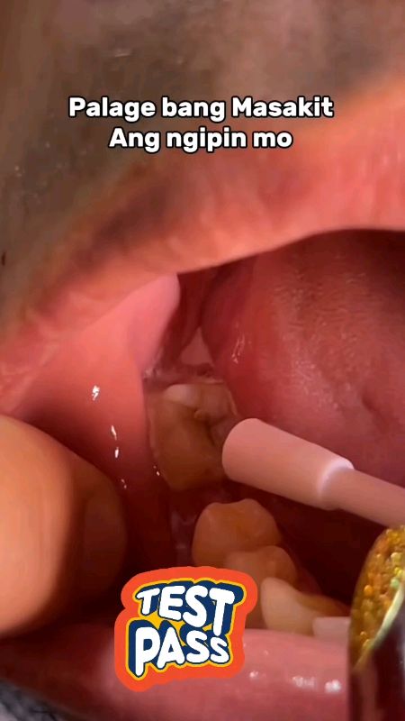 #hack #lifehacks #DIY #toothache #MasMuraSaShopee