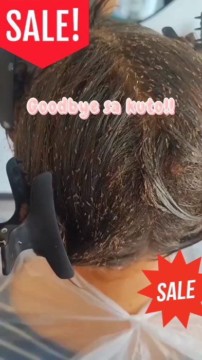 Pangtanggal Kuto!#ShopeePHPaydaySale #FreeCoinsInShopeeVideo #MasMuraSaShopee #tanggalkuto #liceremover #lice #kuto