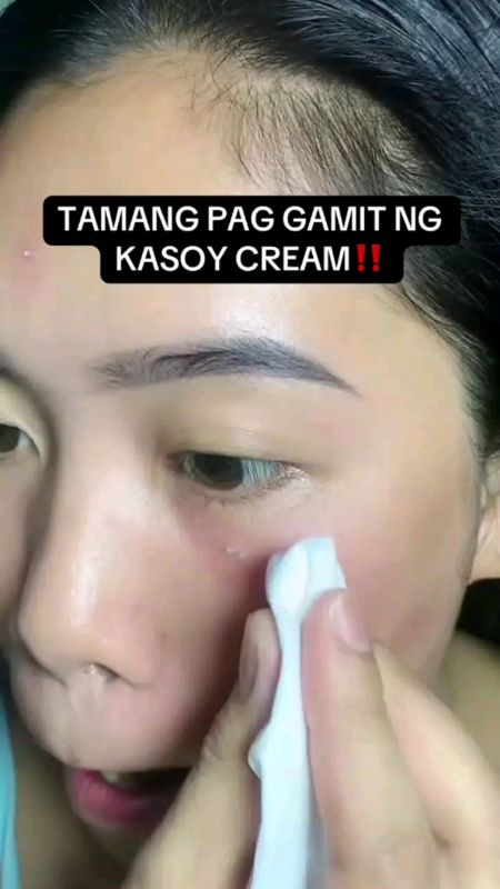 ##FreeCoinsInShopeeVideo '#Miracle kasoy #cream kasoy #cream wart removal warts remover original warts remover cream