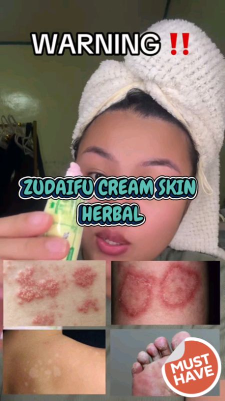 15g MiaoJia Zudaifu Cream Skin Herbal #miaojia #zudaifu #zudaifucream #skinherbal #ointment #MasMuraSaShopee #FreeCoinsInShopeeVideo #trending #fyp
